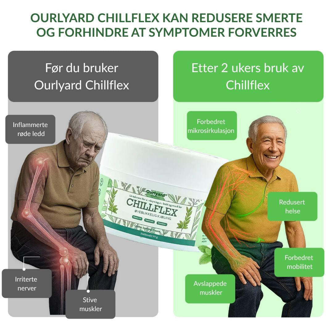 🔥Offisiell butikk: Ourlyard® Chillflex Mint Smertelindrende Krem (Behandling for leddgikt, nervesmerter, revmatiske sykdommer, muskelkramper, rykninger og idrettsskader)