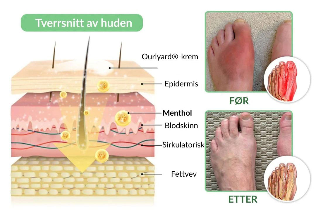 🔥Offisiell butikk: Ourlyard® Chillflex Mint Smertelindrende Krem (Behandling for leddgikt, nervesmerter, revmatiske sykdommer, muskelkramper, rykninger og idrettsskader)