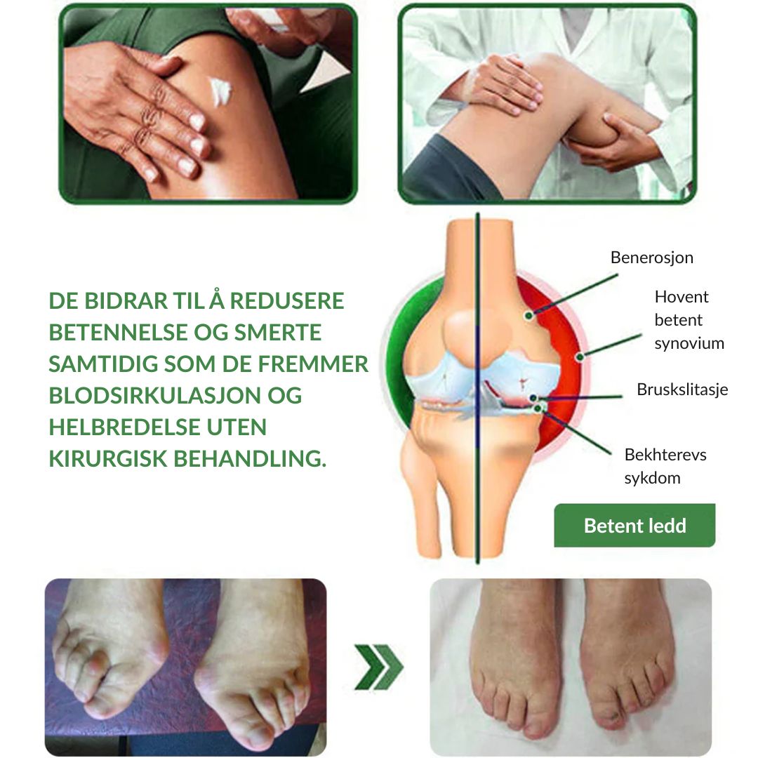 🔥Offisiell butikk: Ourlyard® Chillflex Mint Smertelindrende Krem (Behandling for leddgikt, nervesmerter, revmatiske sykdommer, muskelkramper, rykninger og idrettsskader)