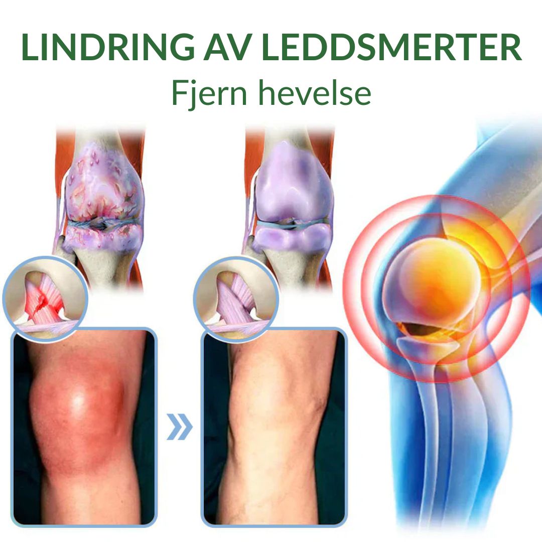 🔥Offisiell butikk: Ourlyard® Chillflex Mint Smertelindrende Krem (Behandling for leddgikt, nervesmerter, revmatiske sykdommer, muskelkramper, rykninger og idrettsskader)