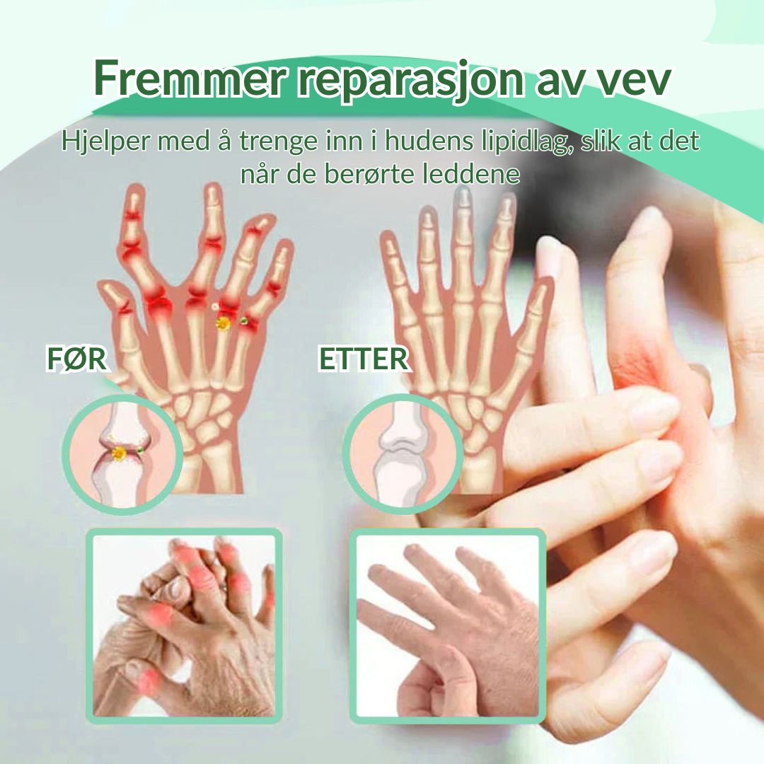 🔥Offisiell butikk: Ourlyard® Chillflex Mint Smertelindrende Krem (Behandling for leddgikt, nervesmerter, revmatiske sykdommer, muskelkramper, rykninger og idrettsskader)