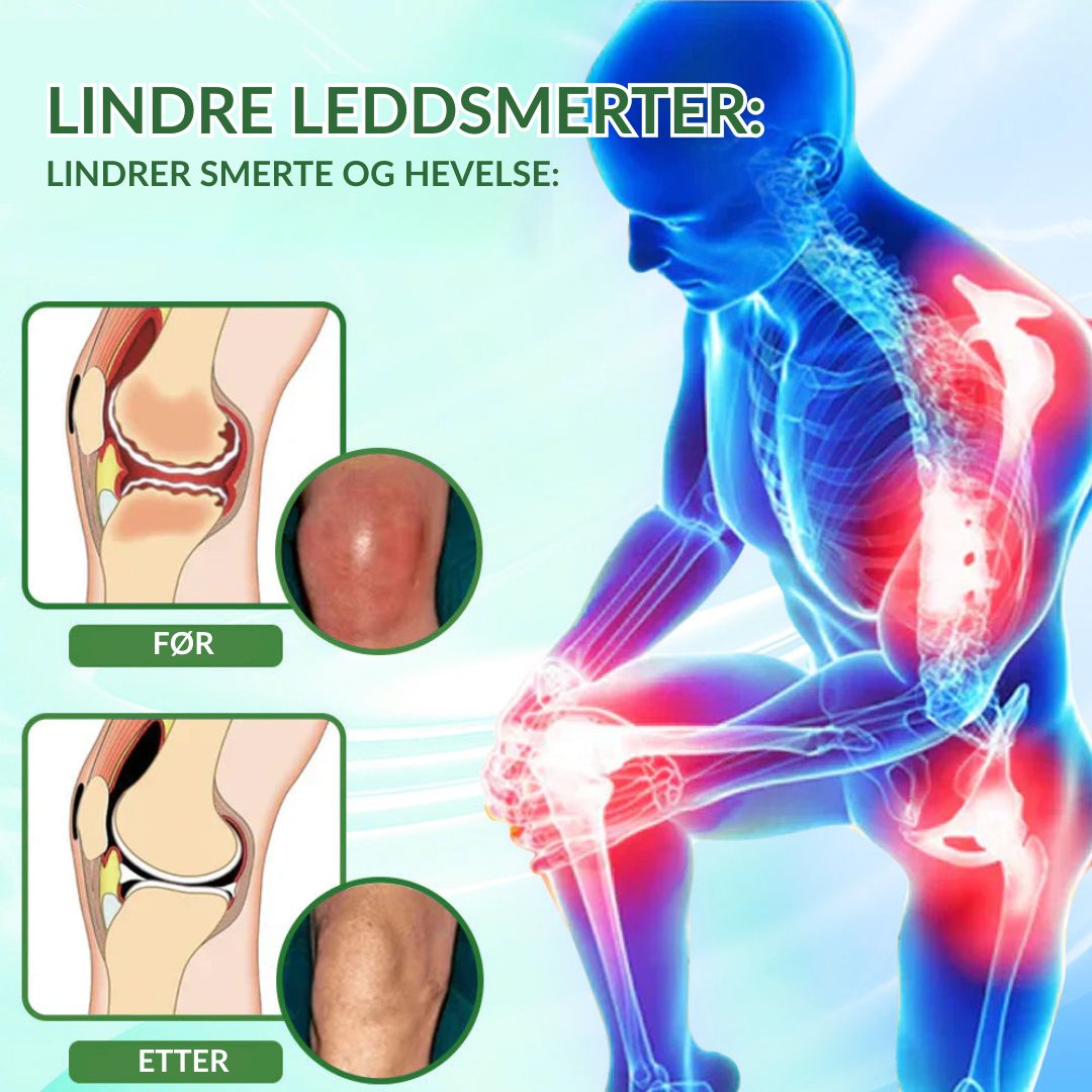 🔥Offisiell butikk: Ourlyard® Chillflex Mint Smertelindrende Krem (Behandling for leddgikt, nervesmerter, revmatiske sykdommer, muskelkramper, rykninger og idrettsskader)