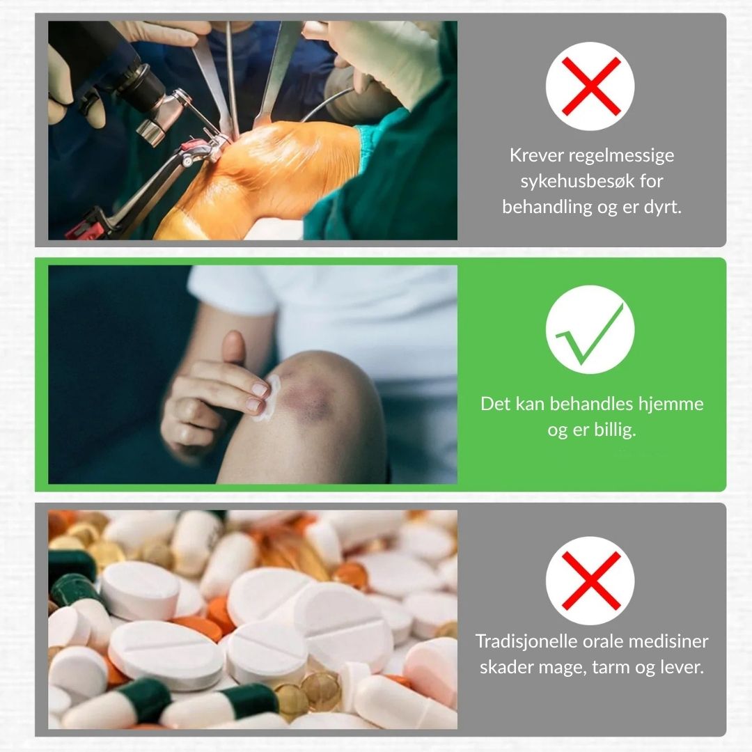 🔥Offisiell butikk: Ourlyard® Chillflex Mint Smertelindrende Krem (Behandling for leddgikt, nervesmerter, revmatiske sykdommer, muskelkramper, rykninger og idrettsskader)