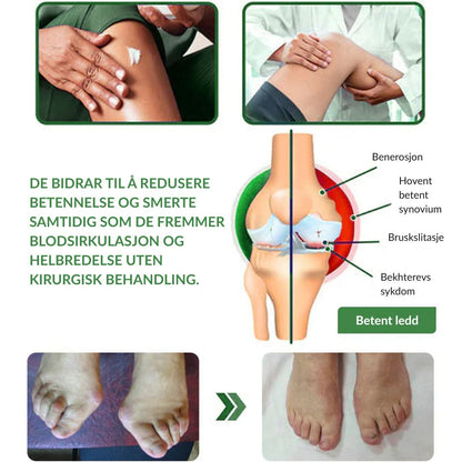 🔥Offisiell butikk: Ourlyard® Chillflex Mint Smertelindrende Krem (Behandling for leddgikt, nervesmerter, revmatiske sykdommer, muskelkramper, rykninger og idrettsskader)