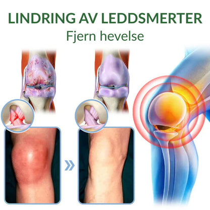 🔥Offisiell butikk: Ourlyard® Chillflex Mint Smertelindrende Krem (Behandling for leddgikt, nervesmerter, revmatiske sykdommer, muskelkramper, rykninger og idrettsskader)
