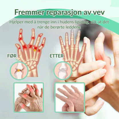 🔥Offisiell butikk: Ourlyard® Chillflex Mint Smertelindrende Krem (Behandling for leddgikt, nervesmerter, revmatiske sykdommer, muskelkramper, rykninger og idrettsskader)
